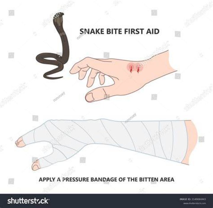 Does peeing on a snake bite help?