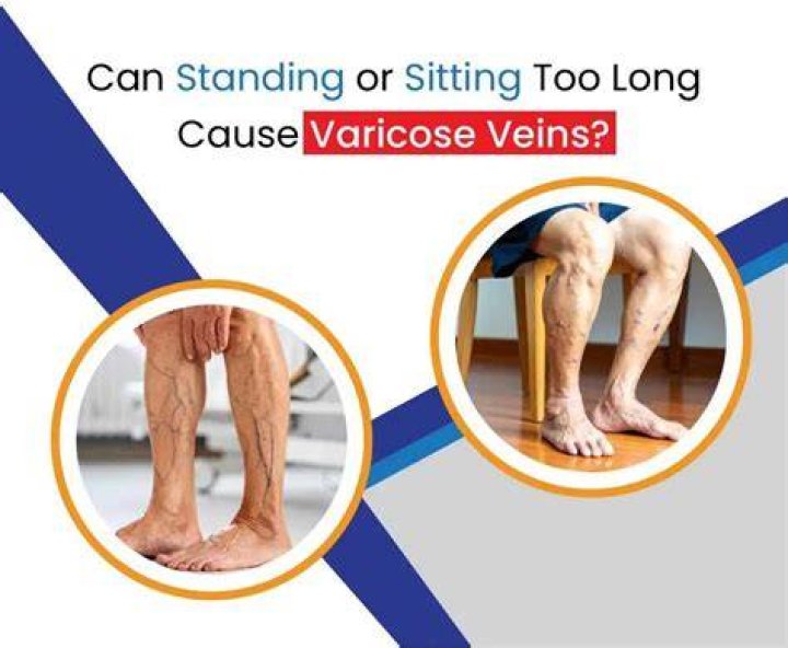Does sitting Indian cause varicose veins?
