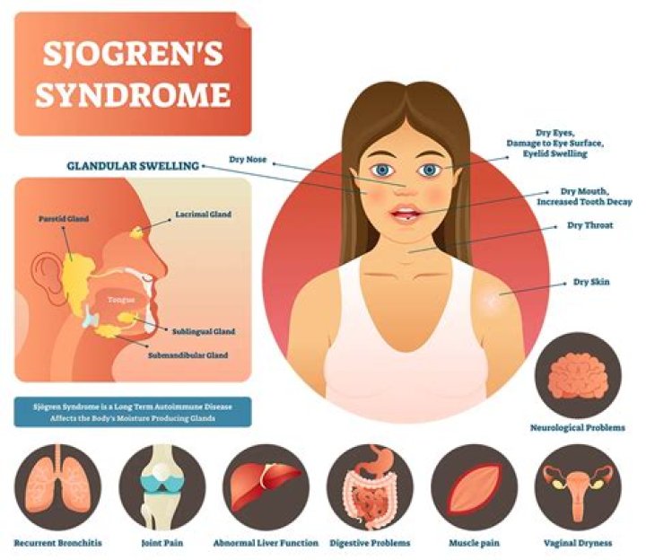 Does Sjogren's affect your heart?