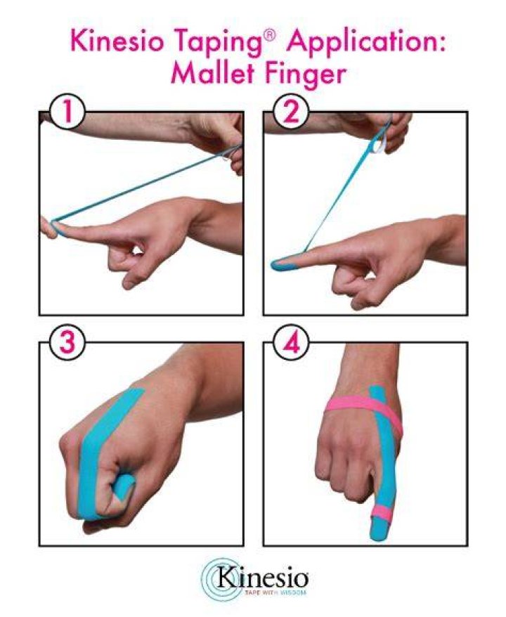 Does taping fingers help arthritis?