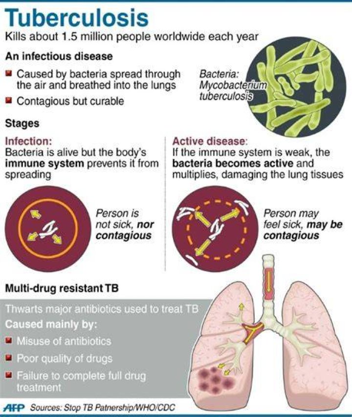 Does TB cause bruising?
