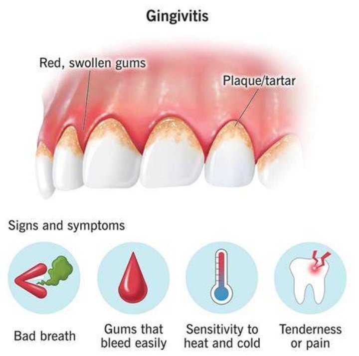 Does throbbing gums mean infection?