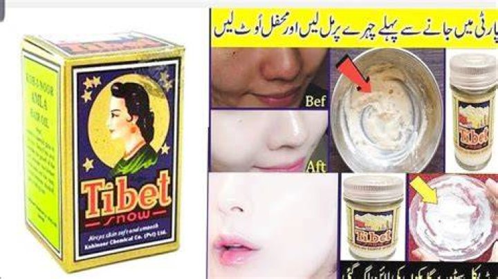Does Tibet cream remove pimples?