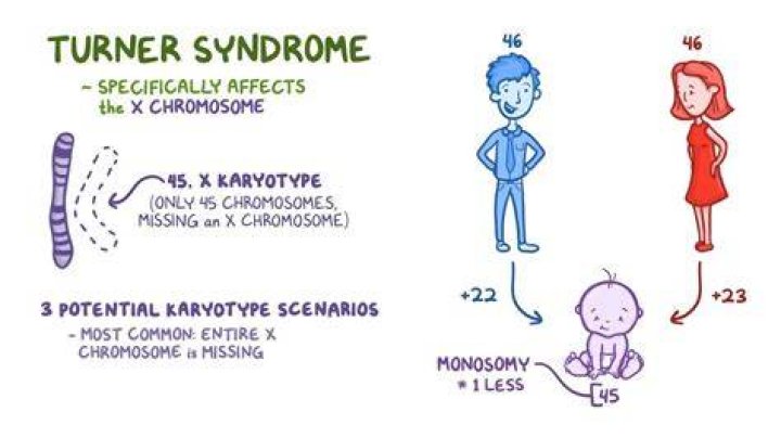 Does Turner syndrome run in families?