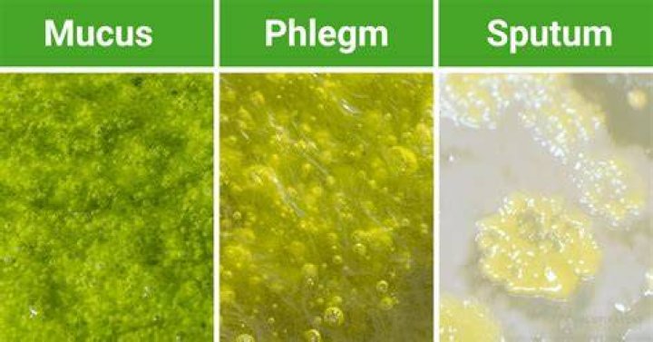 Does yogurt create phlegm?