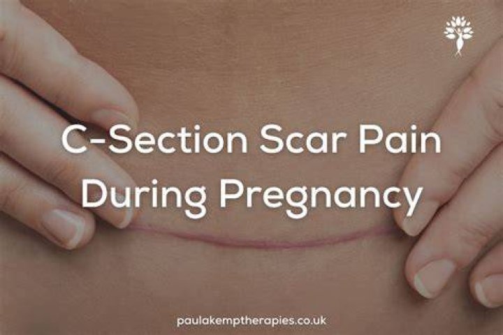 Does your C-section scar hurt when you get pregnant again?