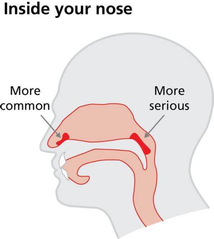 Does your nose come from your mother or father?