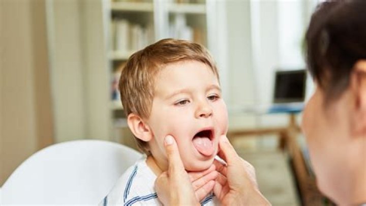 How big is too big tonsils?