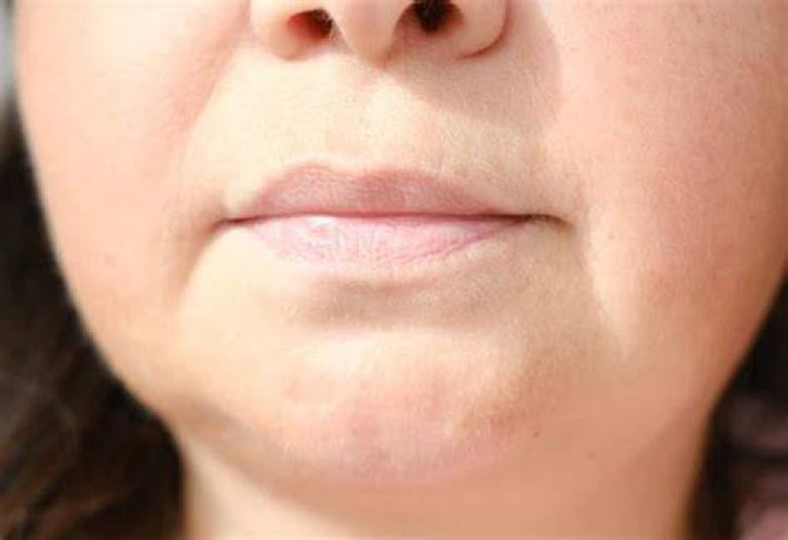How can I tighten the skin around my mouth?