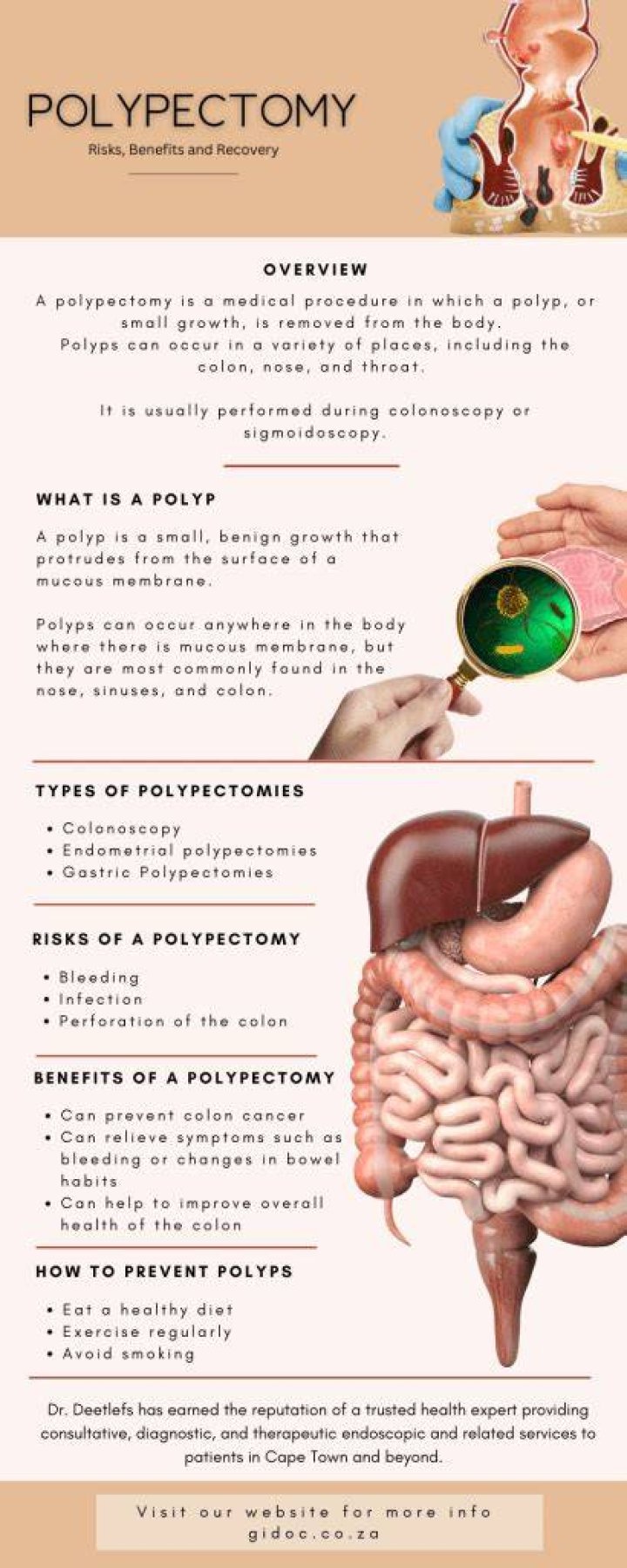 How can polyps be prevented?