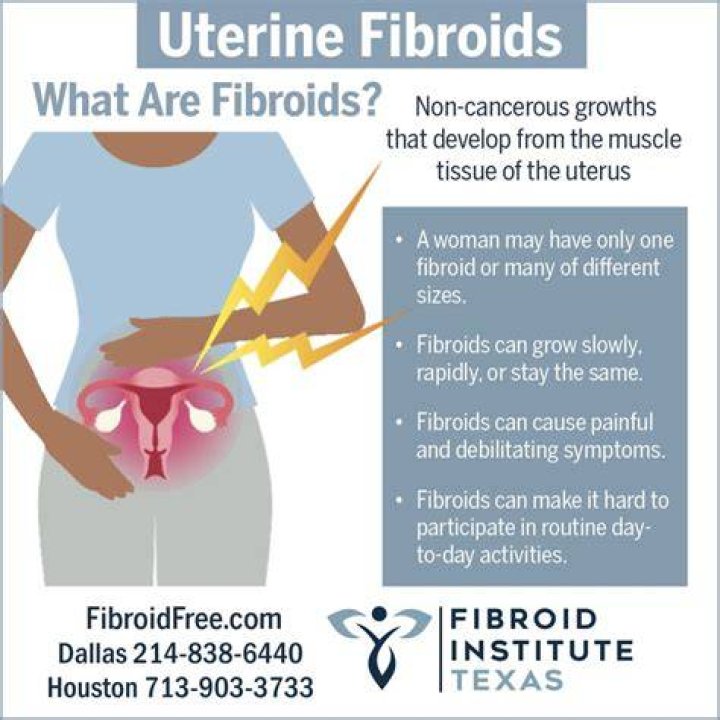 How can you dissolve fibroids?