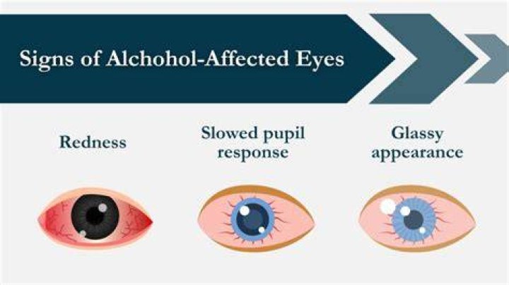 How can you tell if someone's eyes are drunk?