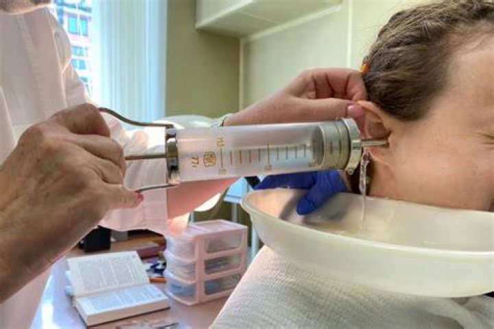 How do doctors syringe ear wax?
