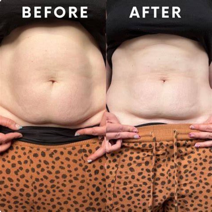 How do I flatten my C-section overhang?