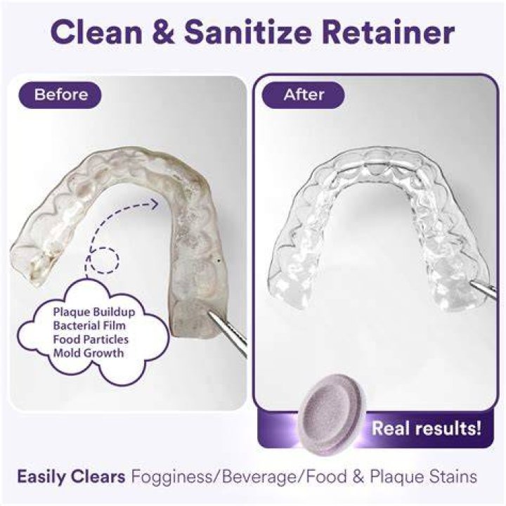 How do I get the white stuff off my retainer?