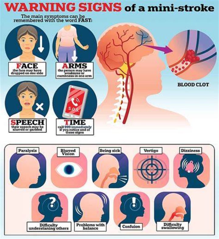 How do I know if I've had a mini stroke?