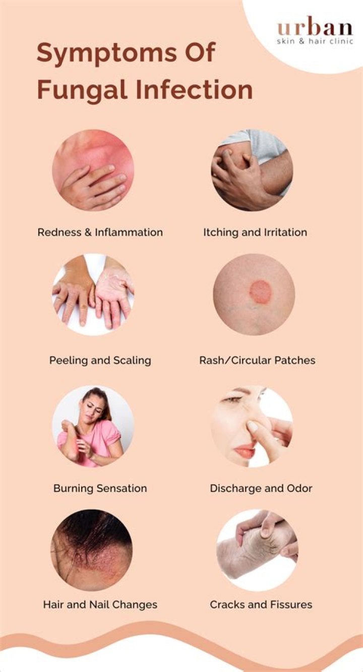 How do I know if my rash is bacterial or fungal?