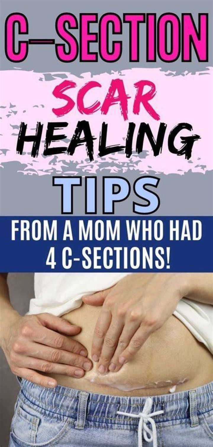 How do I know when my C-section is healed?