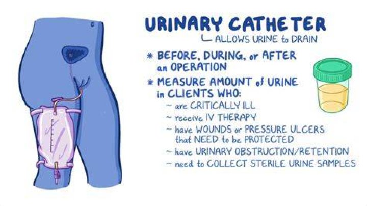 How do they take out a catheter?