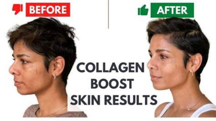 How do you build collagen under your eyes?