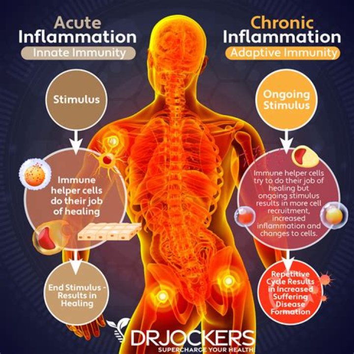 How do you calm inflammation in your body?