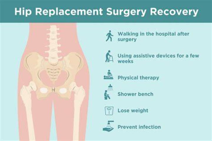 How do you care for someone after a hip replacement?