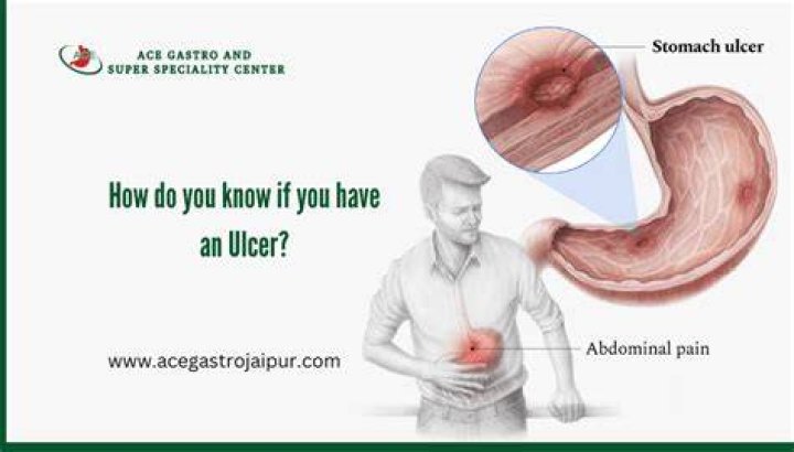 How do you check for ulcer pain?