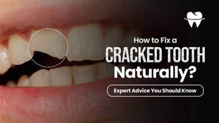 How do you fix a cracked tooth naturally?