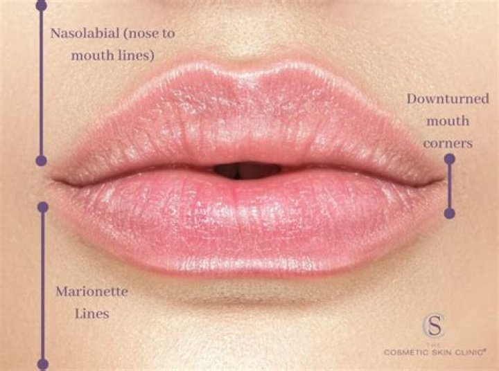How do you fix a sad mouth?