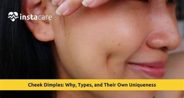 How do you fix dimples on your face?