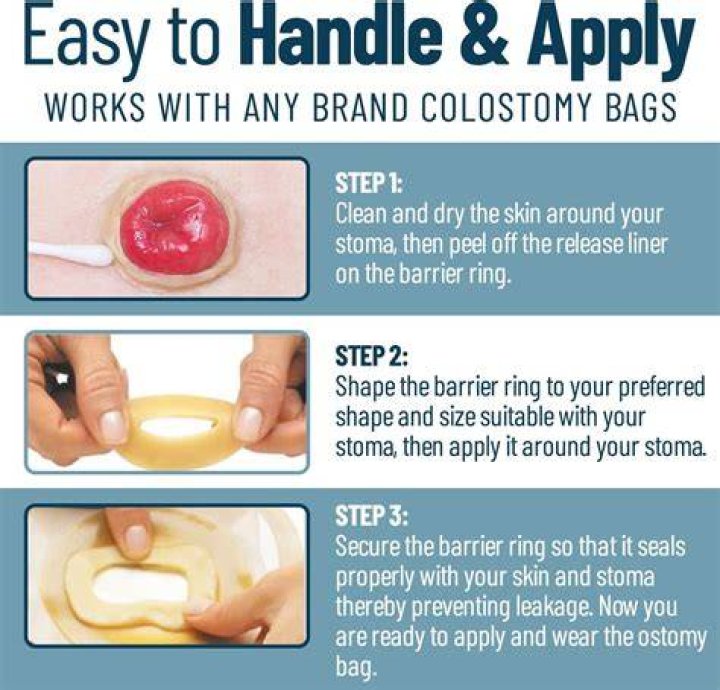 How do you get an ostomy bag to stick?