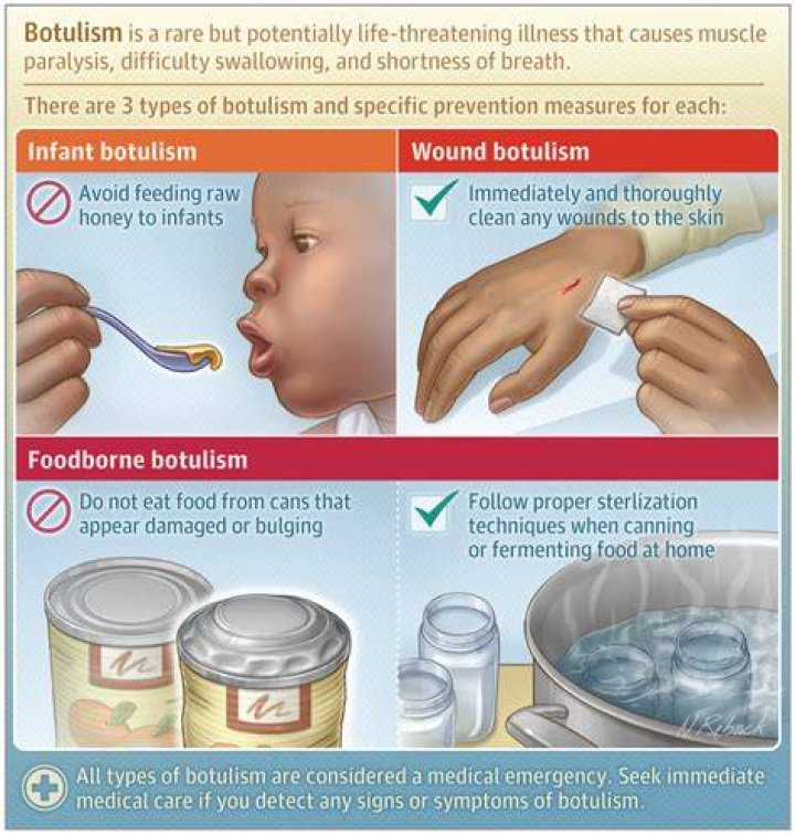 How do you get botulism from garlic?