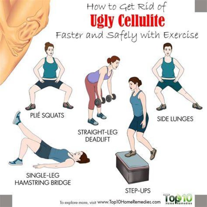 How do you get rid of cellulite on your butt and legs?