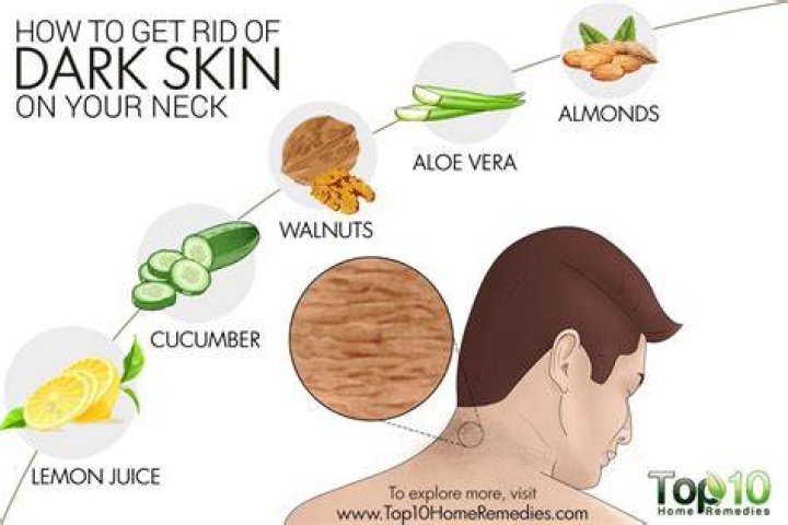 How do you get rid of dark skin?