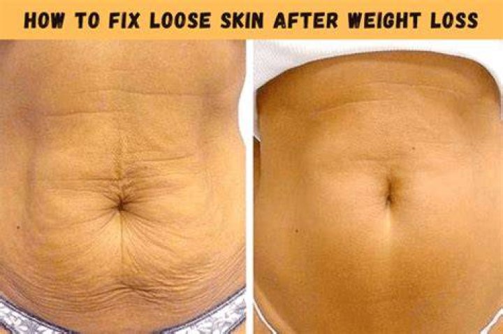 How do you get rid of extra skin on your knees?