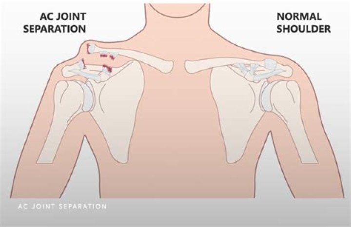 How do you know if a separation is right?