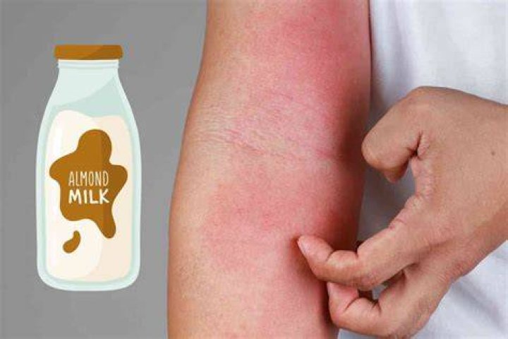 How do you know if you are allergic to almond milk?