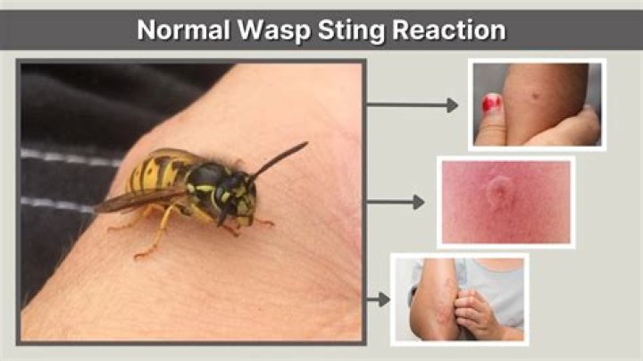 How do you know when a wasp is mad?