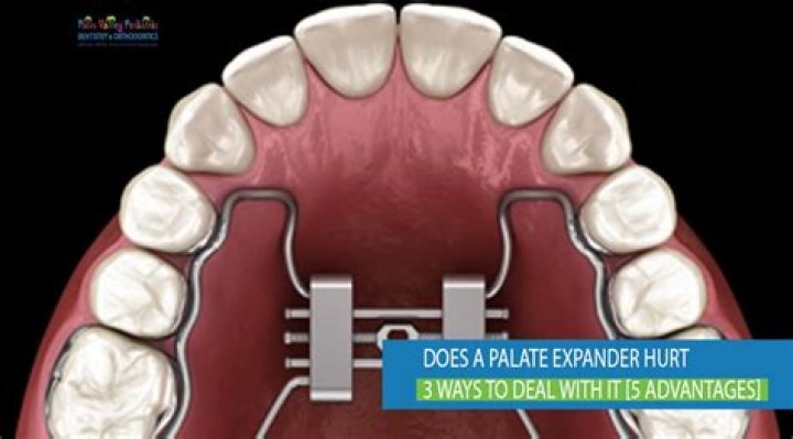 How do you make expanders hurt less?