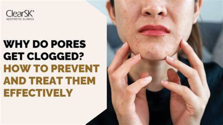How do you melt clogged pores?