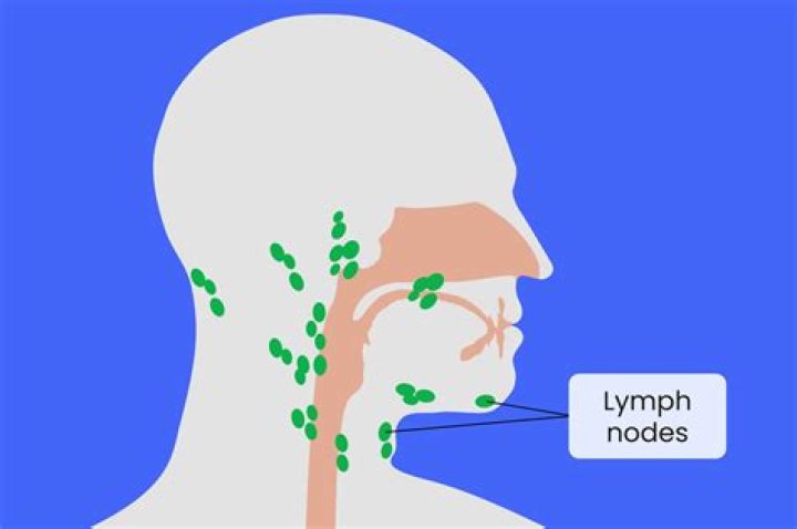 How do you tell if a lump is a lymph node?