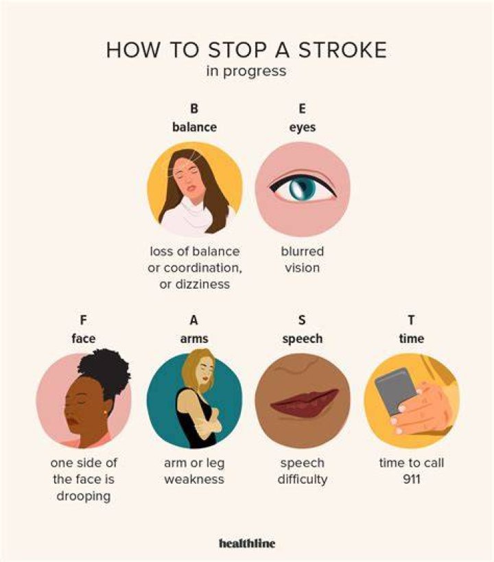 How do you tell if a stroke is coming on?