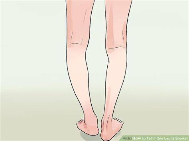 How do you tell if one leg is shorter than the other?