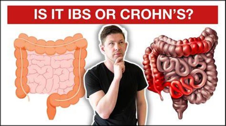 How do you test for Crohn's or IBS?