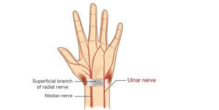 How do you treat nerve pain in your wrist?