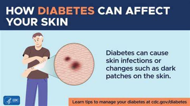 How does a diabetic feel in the morning?