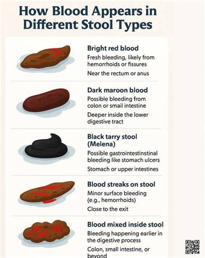 How does blood look like in stool?