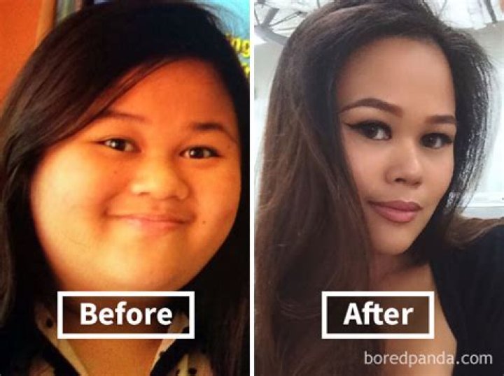 How does losing weight change your face?
