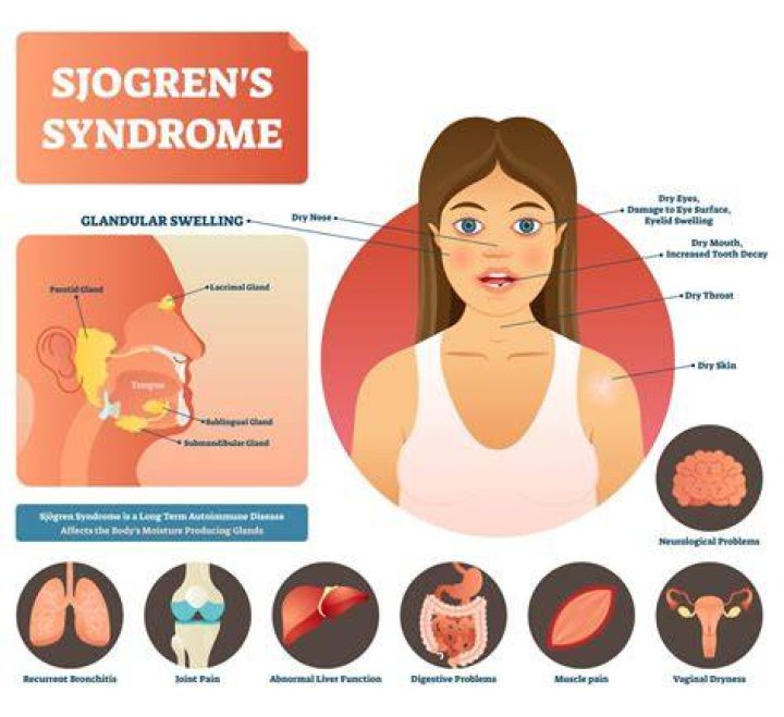 How does Sjogren's affect the stomach?