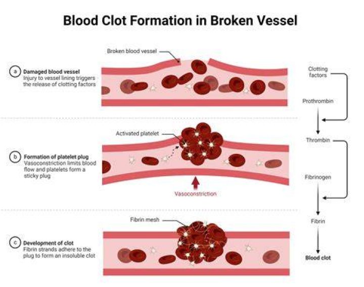 How does the body get rid of blood clots?